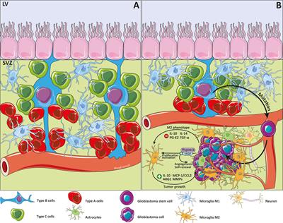 The Role of Microglia in Glioblastoma